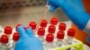 A technician prepares COVID-19 coronavirus patient samples for testing at a laboratory in New York's Long Island. Wide scale testing is a critical part of tracking and containing infectious…