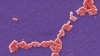 Bacterial Infections 'Second Leading Cause of Death Worldwide'