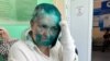 Assaulted Russian Reporter Back in Moscow, Condition 'Difficult' 