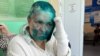 Russian Journalist 'Savagely' Beaten in Chechnya 