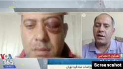 بهزاد همراهی از نابیناشدگان اعتراضات سراسر سال ۱۴۰۱ در ایران