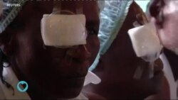 Saúde em Foco: o que é o Glaucoma e como a perda de visão afeta as pessoas no mundo inteiro?