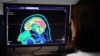 科學家使用腦部掃描和人工智能來“解碼”人類思想