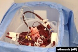 FILE — This photo provided by eGenesis on Jan. 18, 2024, shows a genetically modified pig liver in Massachusetts before transportation to the University of Pennsylvania in Philadelphia in December 2023. (eGenesis via AP)