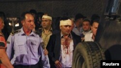 Makedonska policija sprovodi povređene poslanike Sobranja, uključujući lidera SDSM Đorđa Zajeva iz zgrade parlamenta u Skoplju, Makedonija, 27. aprila 2017.