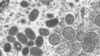 HEALTH-MONKEYPOX-PORTUGAL-SPAIN