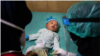 Pakar: Hepatitis Akut Mungkin Tak Mewabah Seperti COVID-19 