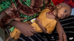 FILE - Hamdi Yusuf, a malnourished child, is held by her mother in Dollow, Somalia, Sept. 21, 2022. Somalia is still feeling the effects of the Russian invasion of Ukraine, as escalating prices for wheat and a drought are putting millions at risk of starvation.