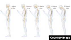 Gambar ini menunjukkan tekanan yang ditanggung oleh leher dan tulang punggung sebagai hasil menunduk untuk melihat smartphone (Courtesy Dr. Ken Hansraj M.D.)