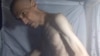 Iran Releases Emaciated Dissident After Hunger Strike 
