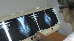 Cancro em Angola - 2:35