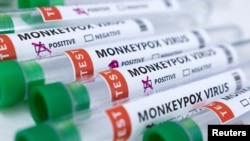 Tabung reaksi berlabel "Virus cacar monyet positif dan negatif" terlihat dalam ilustrasi yang diambil 23 Mei 2022. (Foto: REUTERS/Dado Ruvic)