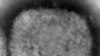 2 Children in US Have Monkeypox, Officials Say 