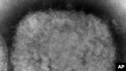 FILE - This 2003 electron microscope image made available by the US Centers for Disease Control and Prevention shows a monkeypox virion.