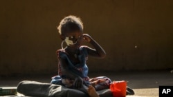 Two-year-old Akon Morro, who is anemic and suffers from edema due to malnutrition, sits on the floor of a feeding center in Al Sabah Children's Hospital in the capital Juba, South Sudan, Dec. 3, 2020. 