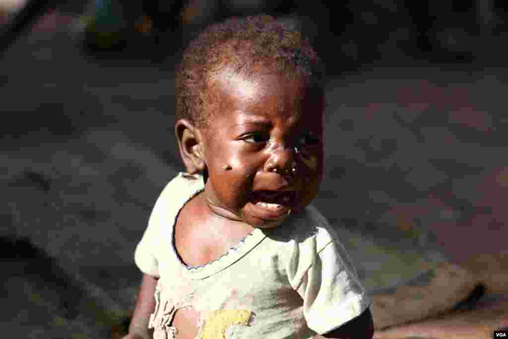 A ragged child cries out for food at Bossangoa's packed Catholic mission, where over 36,000 people have sought refuge from violence, Nov. 10, 2013. (Hanna McNeish for VOA)