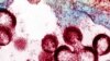 Ethics Debate Mires Kenya HIV-Testing Campaign