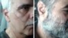 ادامه اعتصاب غذای پنج زندانی سیاسی زندان رجایی‌شهر