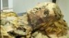 This mummy of an Egyptian woman who was between 45 and 50 years old when she died, is from an unknown era and shows evidence of heart disease. (The Lancet)