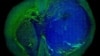 This image of a human glioblastoma brain tumor was made with stimulated Raman scattering microscopy. The technique allows the tumor (blue) to be easily distinguished from normal tissue (green) based on signals emitted by tissue with different cellular structure.
