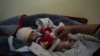 Red Cross Official: Sanctions, Freeze in Donations Add to Afghan Humanitarian Crisis