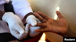Seorang dokter mengambil darah untuk mengecek HIV/AIDS di unit pemeriksaan di pinggiran ibukota Uganda, Kampala, 16 Mei 2014.
