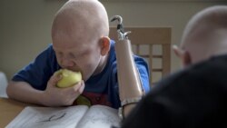 Albinos no Uíge queixam-se de discriminação - 3:00