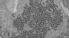 Record Count Reported for Mysterious Paralyzing Illness