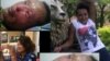 Meseret Nigusse after and before the accedent 