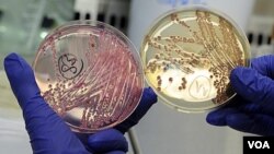 Para peneliti di universitas di Hamburg terus meneliti yang menjadi penyebab wabah E. Coli di Jerman.