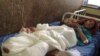 Madina, 10, was collecting firewood in Afghanistan when a roadside bomb went off. She is being treated in a hospital in eastern Jalalabad city, and doctors say she is in stable condition.
