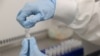 COVAX Program is Evaluating 9 Potential Coronavirus Vaccines, WHO Says 