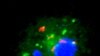 Study: Vitamin D is Powerful Weapon Against TB