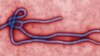 Colorized transmission electron micrograph (TEM) reveals some of the form, structure of an Ebola virus (undated file image).