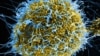 Learning About Ebola, Little by Little