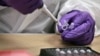 Arhiva - Fragment kosti priprema se za DNK testiranje u laboratoriji u odeljenju za sudsku medicinu u Njujorku, gde naučnici forenzičari vrše poređenje uzoraka za urorcima poginulih u terorističkom napadu 9. septembra.