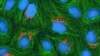 Disabling Protein Cripples Cancer Cells
