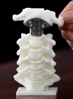 Model tulang belakang yang ditanamkan dengan sumbu buatan yang dicetak 3D ditampilkan di RS Universitas Peking di Beijing, 14 Agustus 2014. Saat ini 95% pasar alat kesehatan implan di Indonesia masih dikuasai impor.(Foto: Reuters/Jason Lee)
