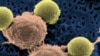 Persediaan Obat Leukemia di Amerika Menipis