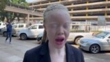 Muzvare Sithembile Kafeso AVO Vane Husope Vachitaura Pamusoro peMhando dzeMafuta Ekuzora Dzinoshanda Zvakanaka Kune Vane Husope vakawanda,
