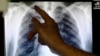 A Bacterium Found in Soil Could Fight Tuberculosis