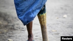 Oo Taung, 50, who lost his leg in a land mine blast in 1994 stands after taking a bath in Zawti village in Kyaukki township January 24, 2013. More than 300 people in Kyaukki Township (population 115,200) in Northern Bago Division, adjacent to once war-tor (ယခင်မှတ်တမ်းဓါတ်ပုံ)