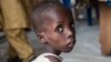 Boy suffering from severe acute malnutrition at a UNICEF nutrition clinic in the Muna informal settlement, which houses nearly 16,000 internally displaced people in the outskirts of Maiduguri, capital of Borno State, northeastern Nigeria, June 30, 2016.
