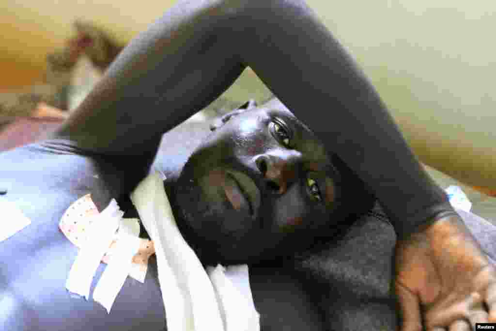 A displaced man, undergoing treatments for his injuries, is seen at a United Nations hospital at Tomping camp, near Juba, Jan. 7, 2014.
