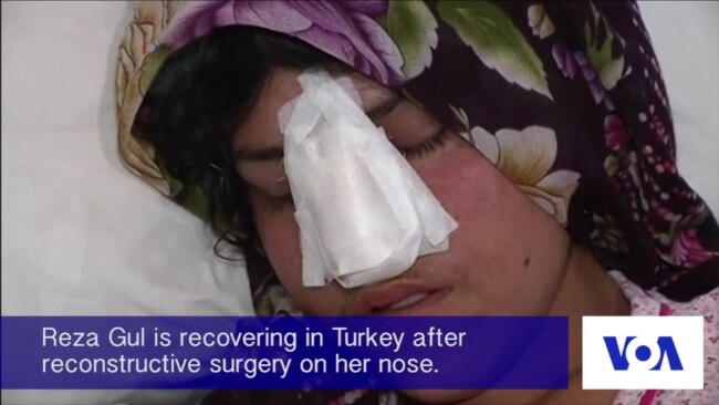 Afghan Woman Undergoes Surgery After Husband Cuts Off Her Nose