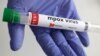 Britain identifies its first case of new mpox variant