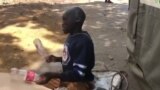 Blessmore Kambuzuma akapofomara maziso nechirwere chaainacho anofarira kuridza ngoma achiridza nziyo dzaAlick Machesu. 