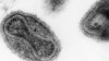 FILE -Smallpox virus