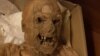 Hungarian mummies excavated from a church crypt in Hungary in 1995 are providing clues to the causes of colorectal cancer. (Photo - courtesy of Tel Aviv University)