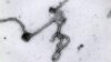 Ebola Pioneer Backs Experimental Drug Tests